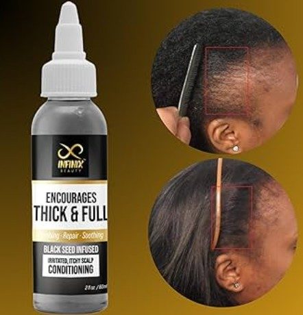 cropped black seeds hair.jpg cropped black seeds hair.jpg